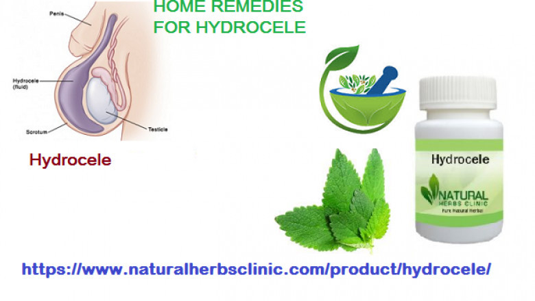 Effective Home Base Prescriptions to Cure Hydrocele Naturally
