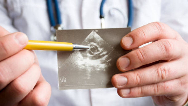 Mitral Valve Stenosis Market: Growth, Opportunities, Key Players & Forecast Outlook 2027