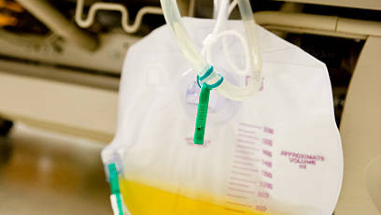 Urinary CathetersMarket: Growth, Opportunities, Key Players & Forecast Outlook 2027