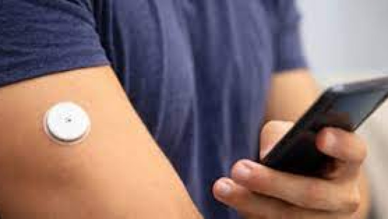 Global Continuous Glucose Monitoring (CGM) Market Growth, Trends, And Forcast 2022 - 2027