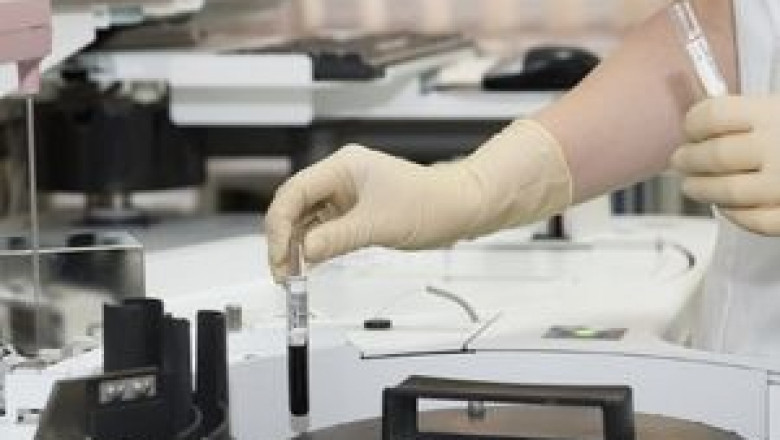 Intravenous Solutions Market Business Strategy, Future Plans, Development Status and Trends by Forecast 2028