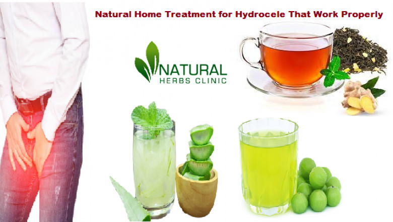 Natural Home Treatment for Hydrocele That Work Properly