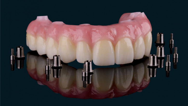 Global Zirconia Based Dental Materials Market: Industry Trends, Share, Size, Growth, Opportunities And Forecast 2022-2030