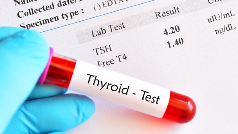 6 Easy Ways To Reduce The Risk Of Thyroid Disease