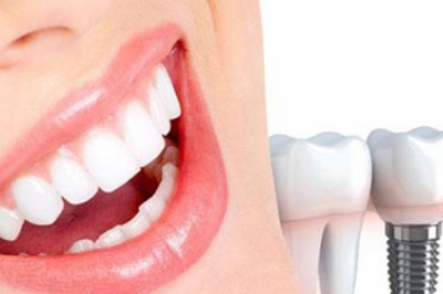 Are Dental Implants Painful?
