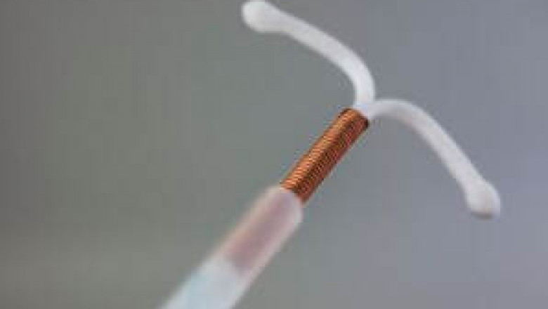 Paragard IUD Lawsuit
