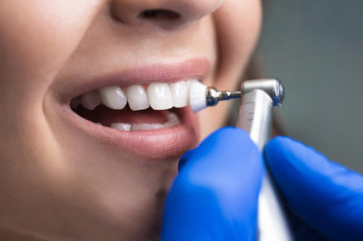 What Are The Benefit Of Dental Implants?