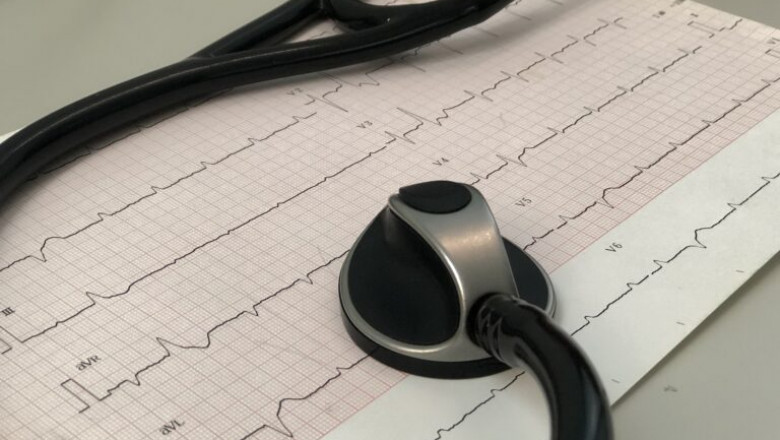 Electrocardiography | Jayapadma Clinic