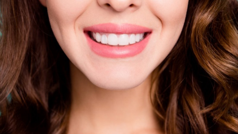 5 Reasons Why You Should Consider Teeth Whitening