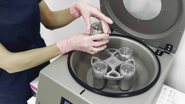 Platelet Rich Plasma – Everything Need to Know