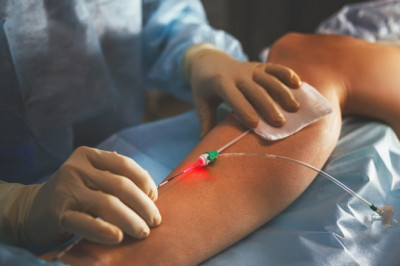 What Treatments Available For Vein Disorder?