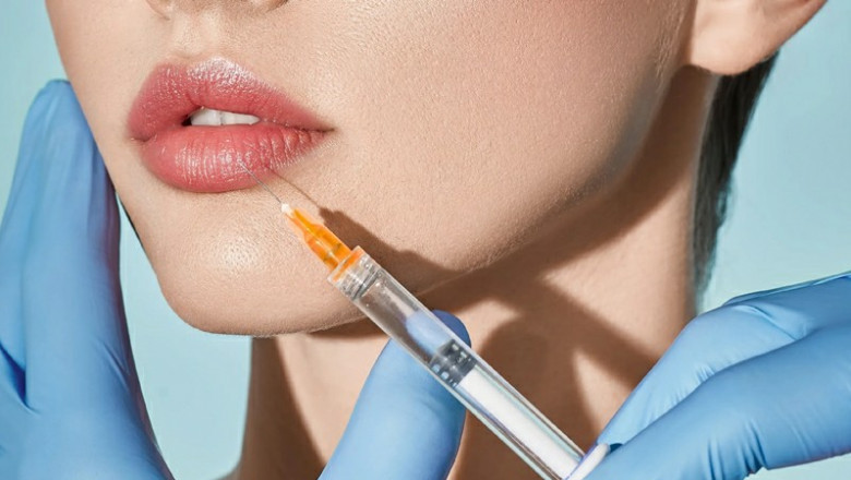 lip filler injection physiognomy