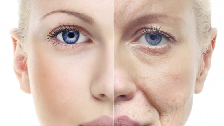 Global Impact of Covid-19 on Anti-aging Treatment Market