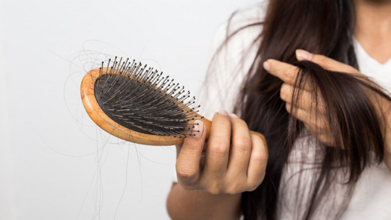 Hair loss at young age
