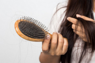 Hair loss at young age