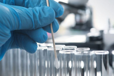 What are Forensic Evidence and DNA Evidence?