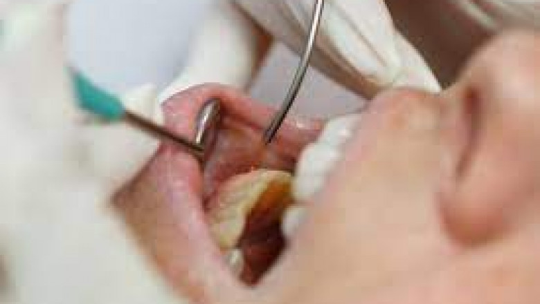 Why Is Laser Gingivectomy Important In Dentistry?