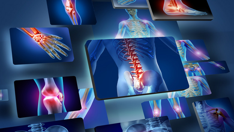 Rheumatology Therapeutics Market Dynamics