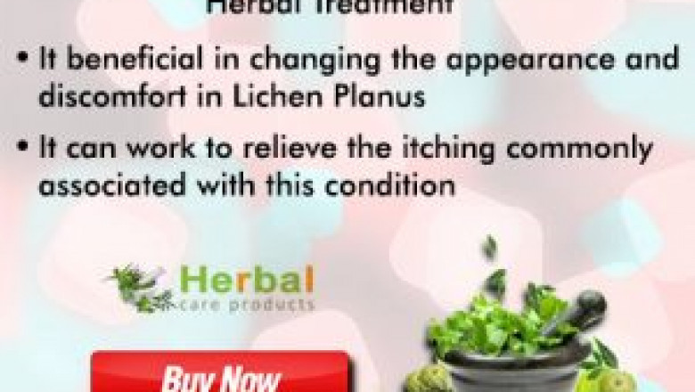 Top 9 Natural Treatments for Lichen Planus