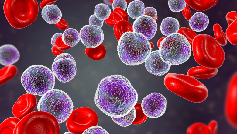 Leukemia Therapeutics Market Regional Insights