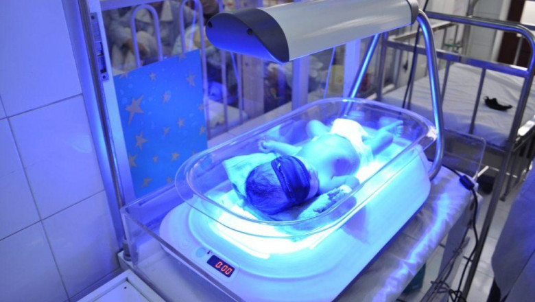 Major factors that are propelling the global phototherapy equipment market forward