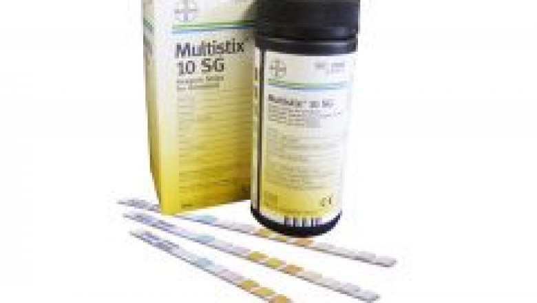 7 Different Types of Urine Tests
