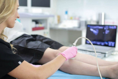 When Should I Be Worried About Varicose Veins?