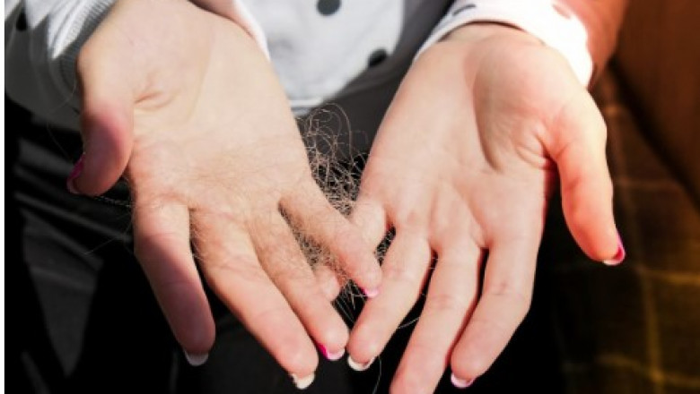 Besthairtransplant