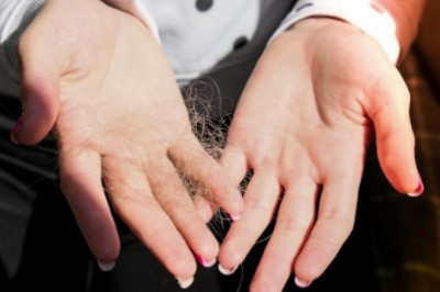Besthairtransplant