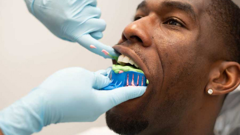What You Know About Root Canal Treatment, And Why Is It Needed?