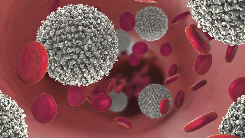 Acute Lymphoblastic Leukemia Therapeutics Market Restraints
