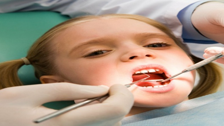 Who is the best one to do an implant?