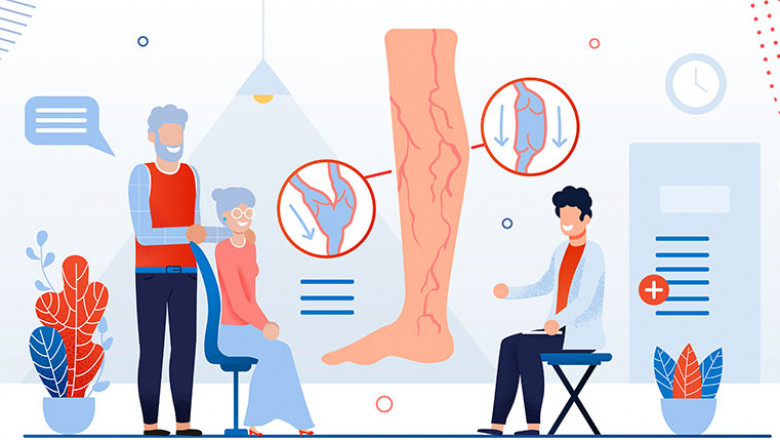 Diagnosis and treatment of Varicose veins