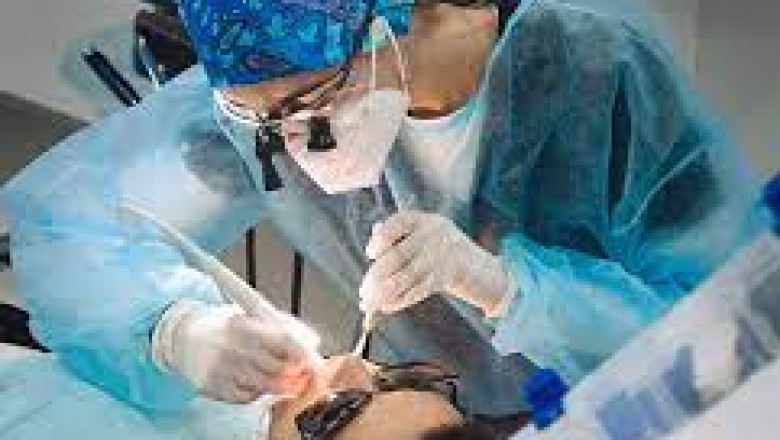 What Should You Know About Dental Bridges?