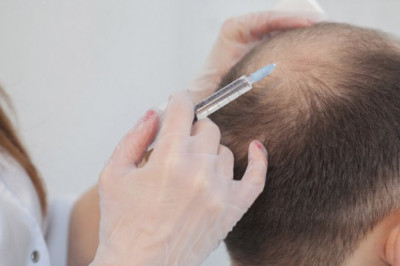 Hyperthyroidism and hair loss.