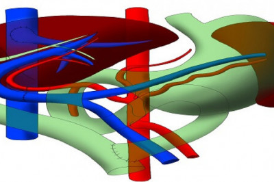 Liver Transplant Cost in India | Shalby Hospitals