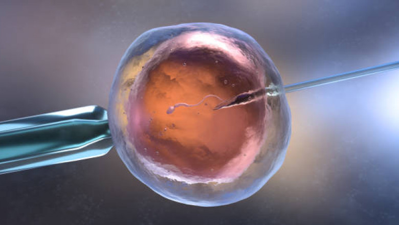Asia-Pacific In-Vitro Fertilization Market Size, Share, Demand Forecast from 2020 to 2025