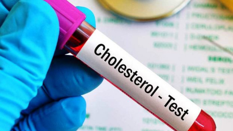 Global Cholesterol Testing Services Market Size, Share, Impressive Company Growth, Report 2027