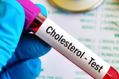 Global Cholesterol Testing Services Market Size, Share, Impressive Company Growth, Report 2027
