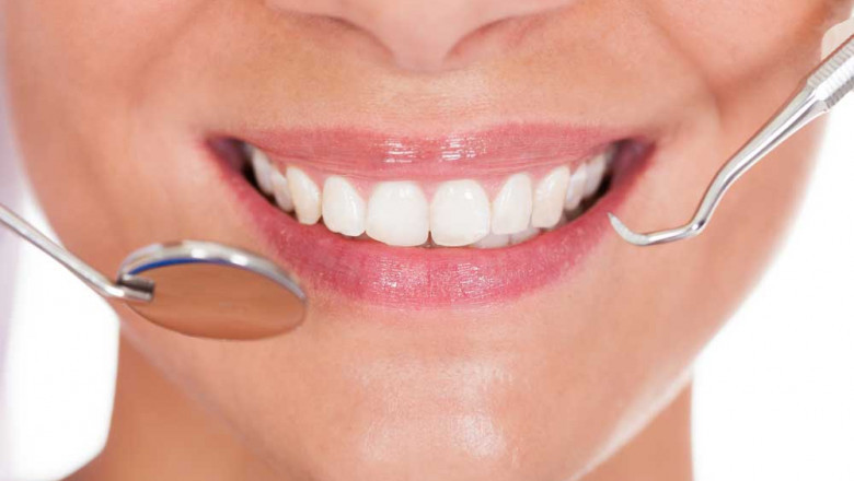 What is Gingivectomy?