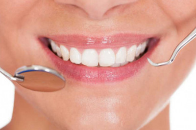 What is Gingivectomy?