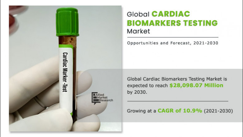 Cardiac Biomarkers Testing Market: Analysis, Growth Drivers and Trending Factors