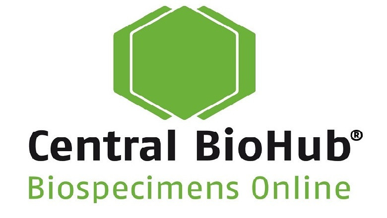 Hyperthyroidism | Human Biospecimens | Order Online