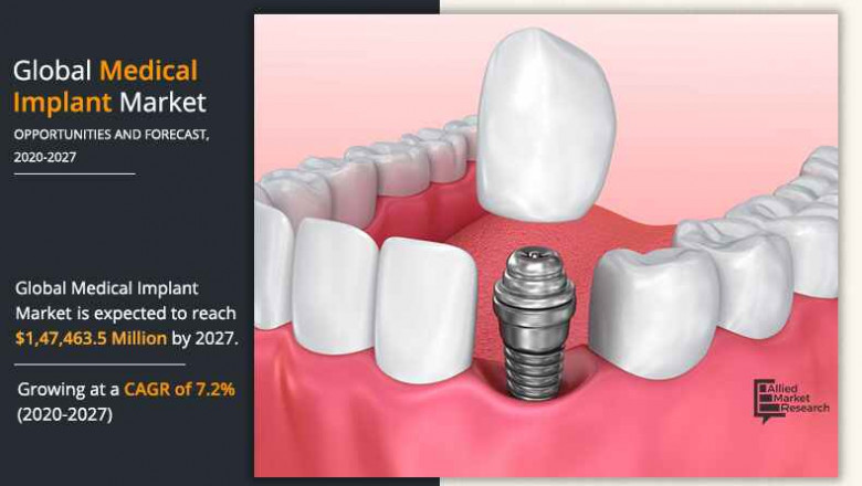 The metallic biomaterials segment to maintain its lead position by 2027