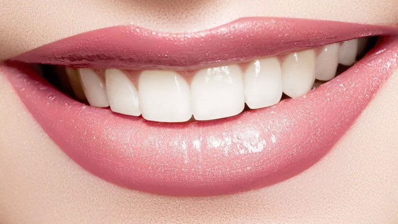 Things You Need To Know To Prep For Teeth Whitening | Tower House Dental Clinic