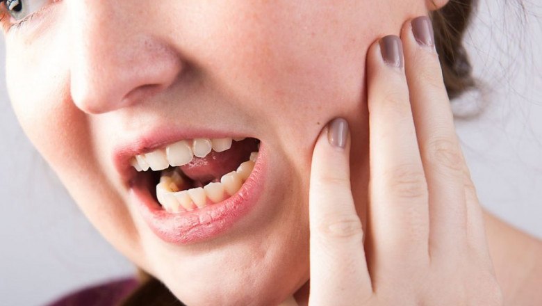 What Are The Beneficial Aspects Of Dental Implants?