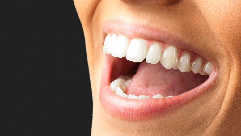 Why Do People Require Dental Implants?