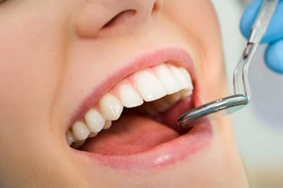 What Are The Beneficial Aspects Of Invisalign Clear Aligners?