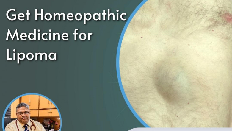 Effective Lipoma Treatment in Homeopathy at Dr. Singhal Homeo