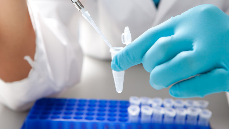 Know in brief about In Vitro Toxicity Testing